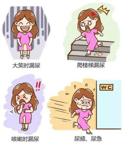 拒绝产后漏尿!专家教你正确科学的产后修复