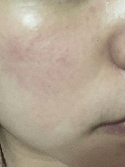 自救|皮肤敏感自救指南，找对原因才能轻松拯救！