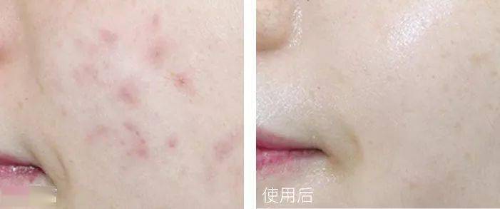 脸蛋|你的脸蛋“一键美颜”,除了滤镜还靠什么?