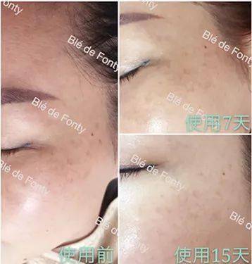 脸蛋|你的脸蛋“一键美颜”,除了滤镜还靠什么?