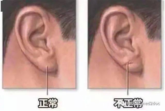 什么是动脉硬化性心脏病 b48712ec1f7f4c38862a5c5437ac212b.jpeg