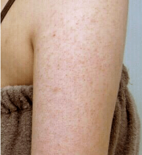 皮肤|白到发光的张雨绮性感冲出屏幕!这次成了“直女斩”