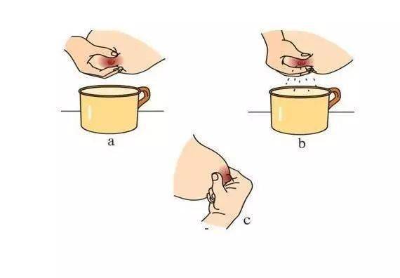 正确挤奶 手动挤奶的方法: 将大拇指放在乳晕上方,其他手指放在乳晕