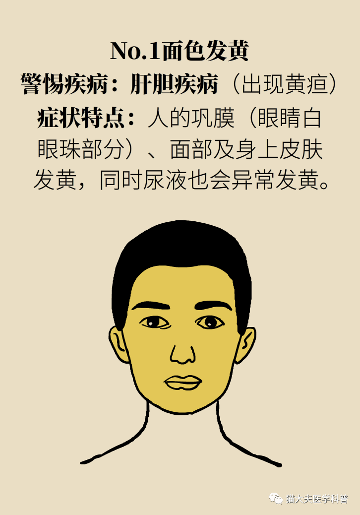 变什么什么厉成语_等什么君(2)