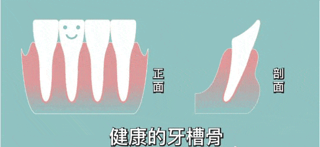 【惊呆】30多岁的小伙子因牙齿松动就诊,结果全口牙齿