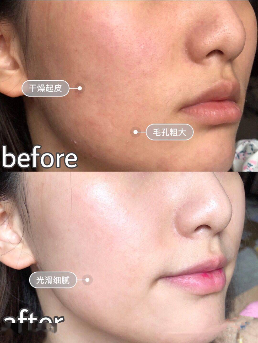 兰蔻大|这次的兰蔻大粉水跳楼价，看到直接下单抢！