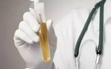 尿液|箭头高高低低看不懂？不懵圈、不求人，一篇教你看懂尿常规！