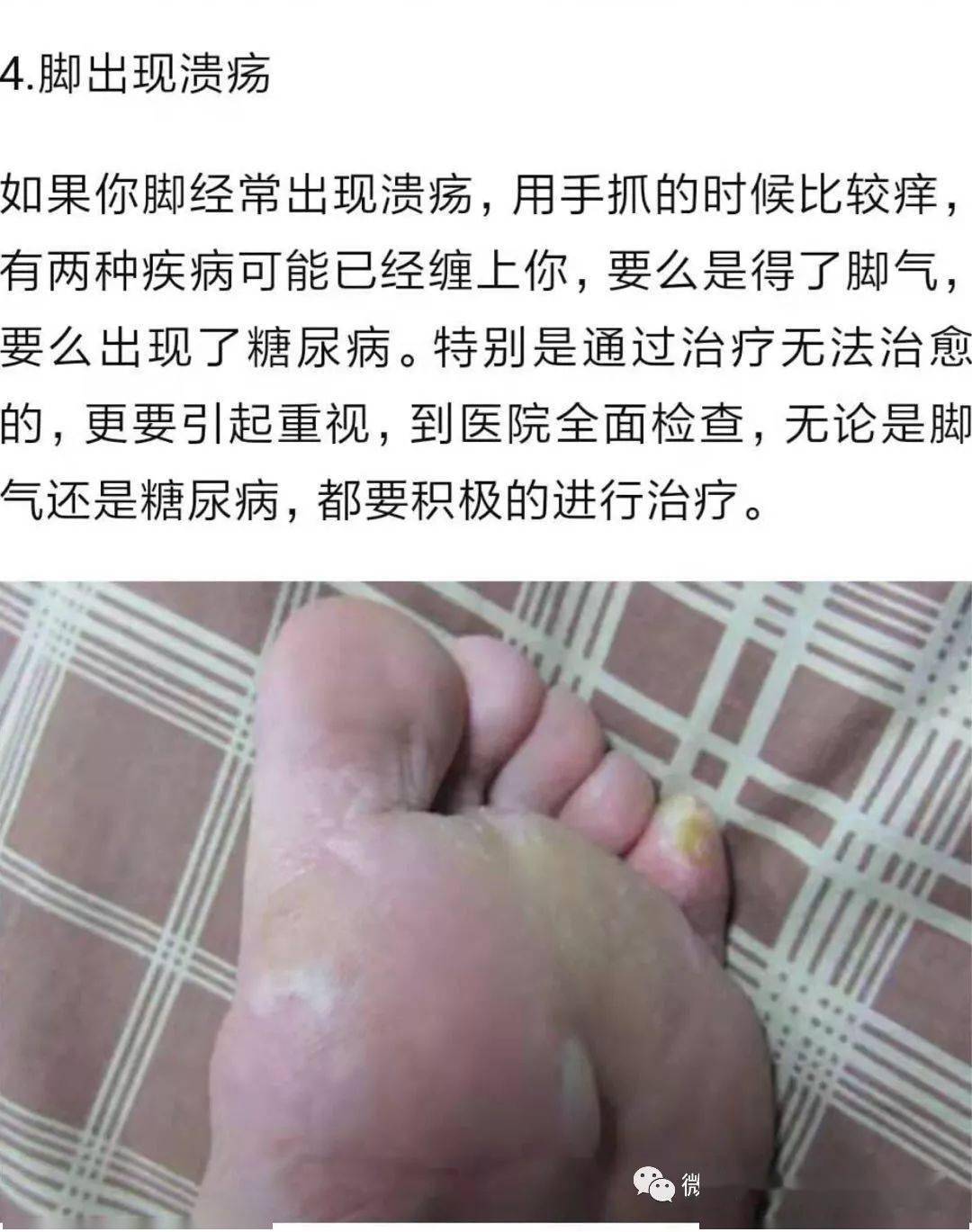 自己怎样给自己按摩脚底 aaf853993621423a980885a2494e6afc.jpeg