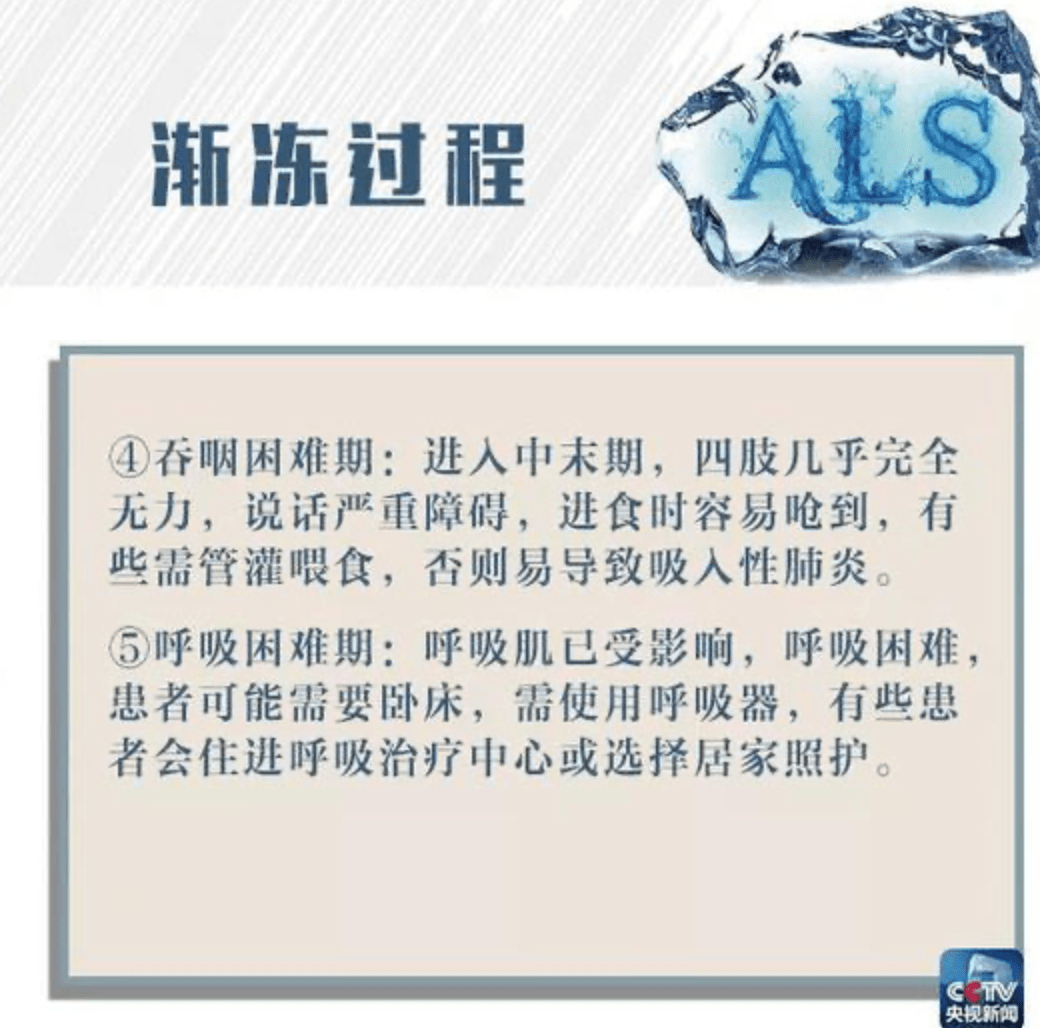 患者|渐冻症患者有药了！张定宇走路时步履蹒跚着实让人心疼...