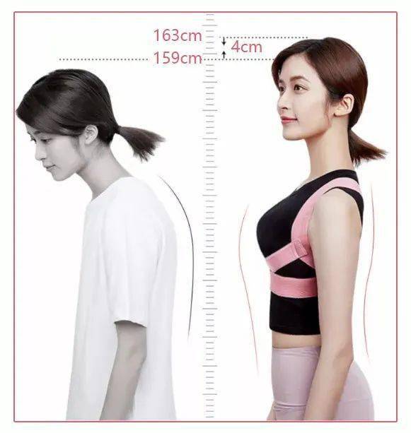 智商|张雨绮的矫姿带到底是智商税，还是真女神制造机？