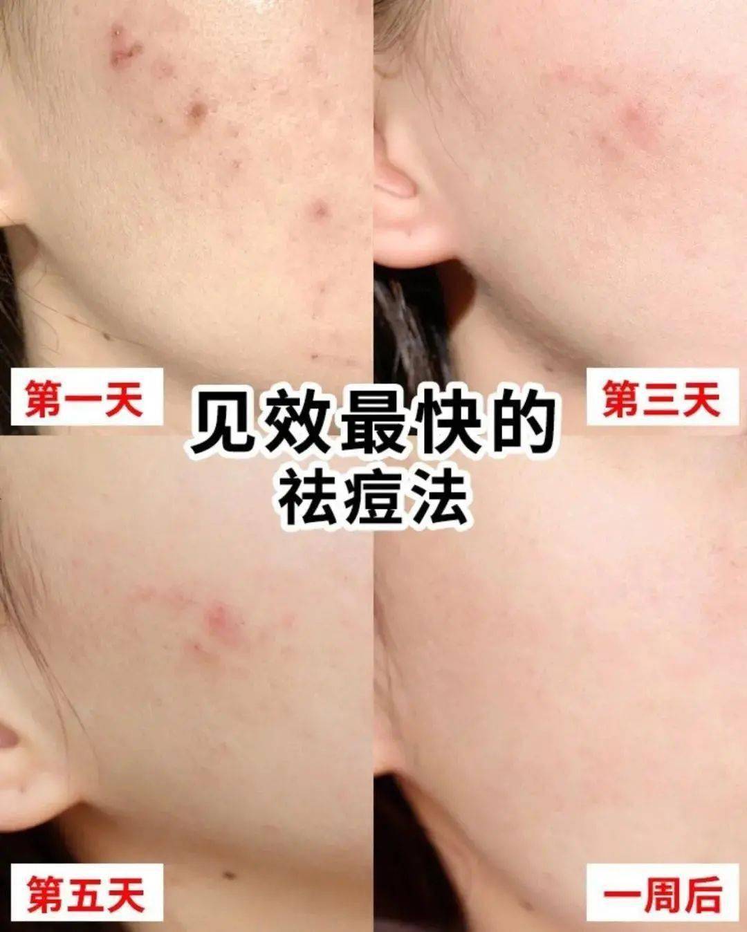 贫民窟|杨幂熬夜后护肤要花2万块？怪不得皮肤吹弹可破！贫民窟女孩就不配消除熬夜痘、黑眼圈吗？