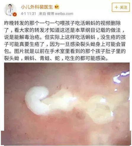 孩子|【震惊】5岁女童突然肝衰竭、昏迷不醒！竟是因为爸爸煮的“药”……