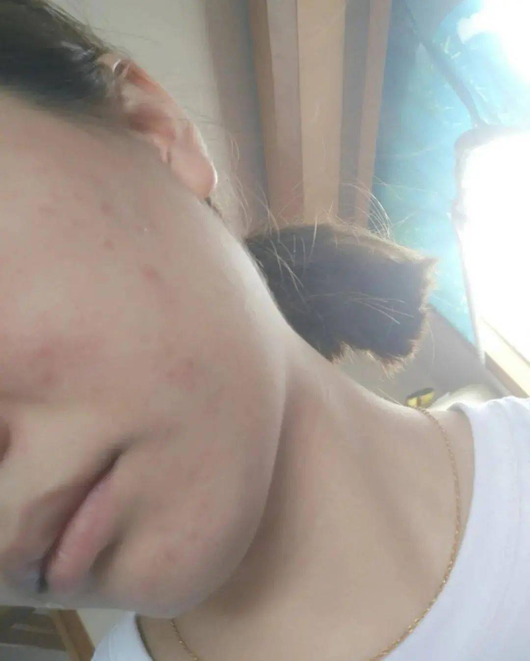 贫民窟|杨幂熬夜后护肤要花2万块？怪不得皮肤吹弹可破！贫民窟女孩就不配消除熬夜痘、黑眼圈吗？