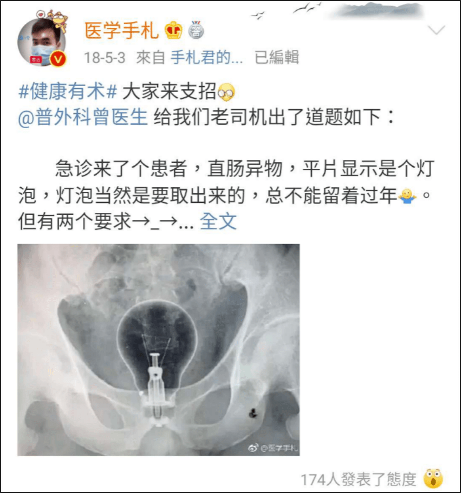 异物|【周日】罗非鱼“游”进肛门，医生在直肠里找到啤酒杯、茄子、灯泡、泥鳅.....