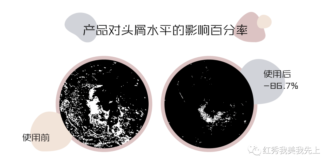 评测|控油洗发水实验评测丨总出油的头发还有救吗？