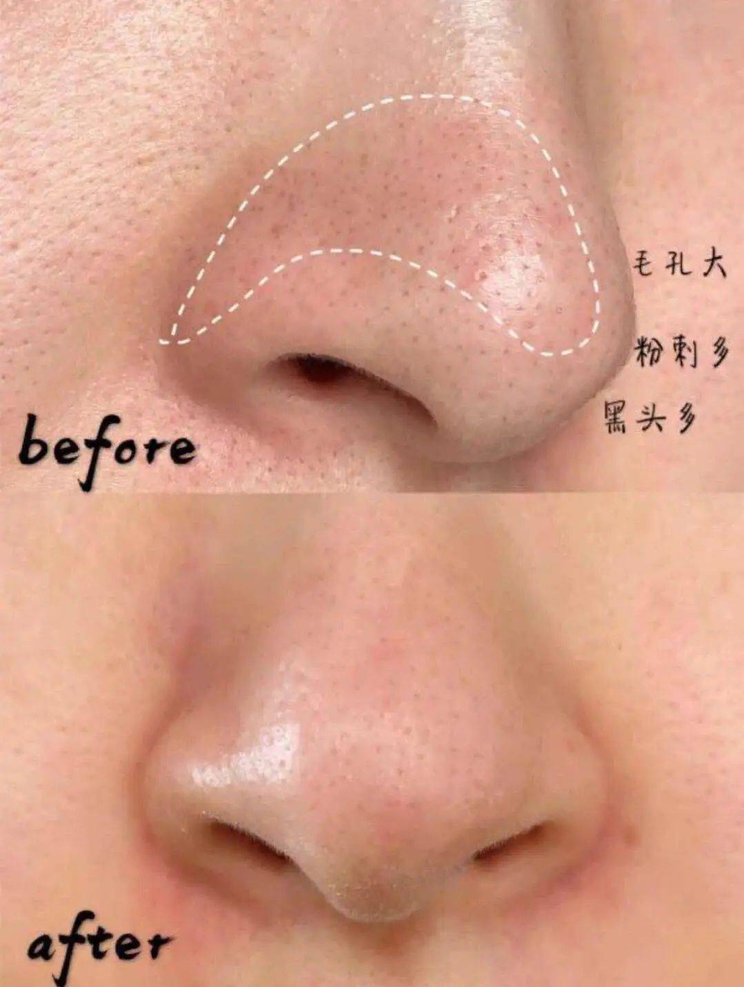 潘达|日本20年老木头,经1300°高温烧成“变态黑炭”,几分钟溶掉黑头,太神奇!