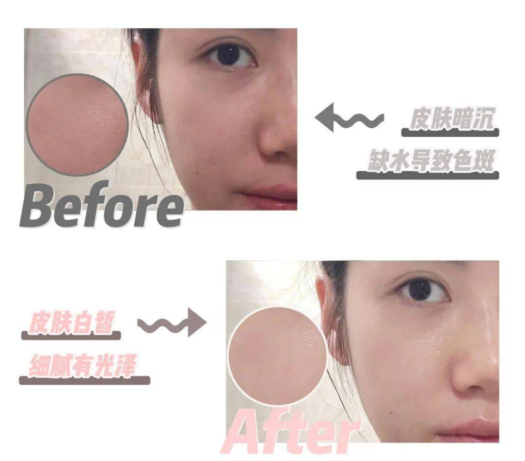 小气泡|花9块钱在福州这家店做了医美,做完就后悔了!