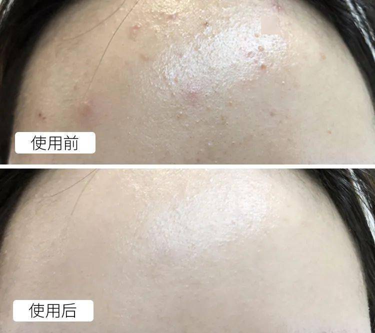 潘达|日本20年老木头,经1300°高温烧成“变态黑炭”,几分钟溶掉黑头,太神奇!