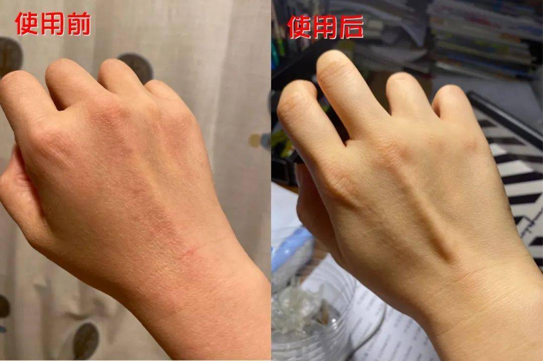Kidston|小美宝箱精选|卖断货的小众护手霜又来了！超级滋润不油腻，秋冬有这1盒就够了！