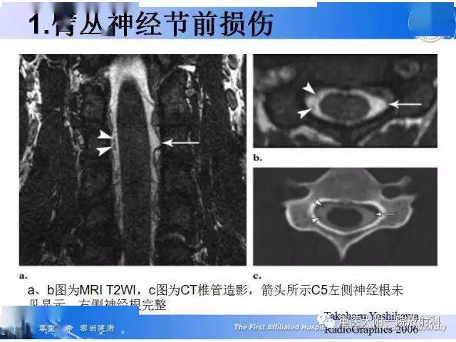 神经病怎么诊断 4c69254ea4cb4986bbff4874d24bac4e.jpeg