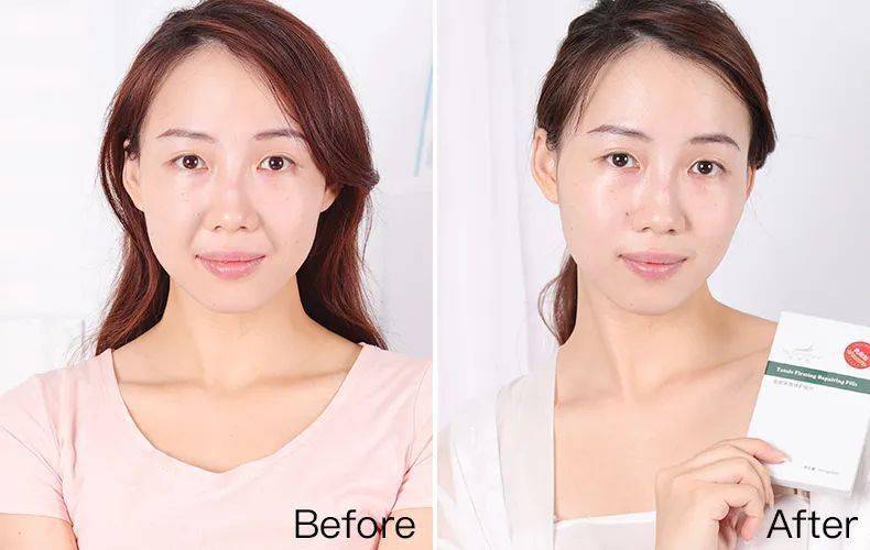 网友|47岁阿姨直播，“法令纹”2分钟磨平！网友炸锅：神仙操作！