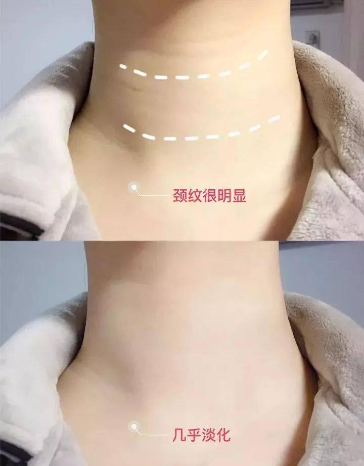 美容|以色列美容仪太牛！千万红人都用它提拉、导入、清洁，还有18K真金护理头