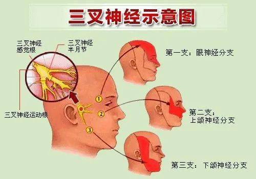 血管|人体最痛的六种病，痛风仅排第五！希望你一个都没经历过