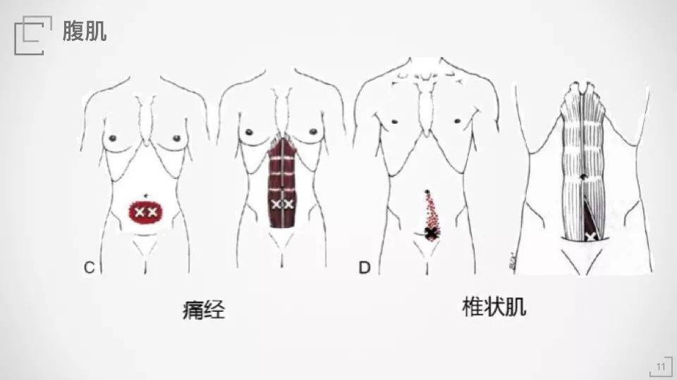 腹直肌——你真的清楚它的解剖和功能吗