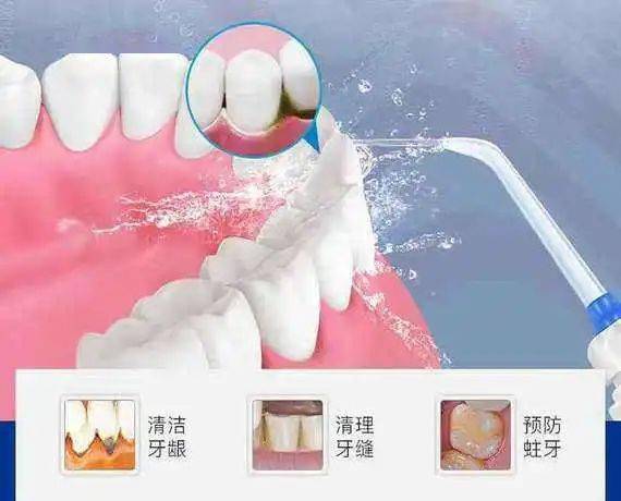 有什么办法让牙龈再生长 a257f10543484286a18ad6220698f348.jpeg