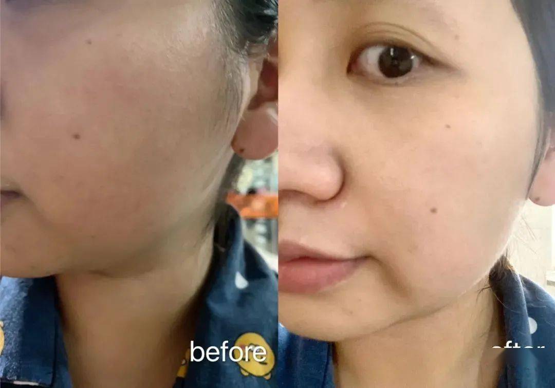 Bug|寻芳记｜换季肤况出Bug？听说比奶茶还甜的她们都用这招！