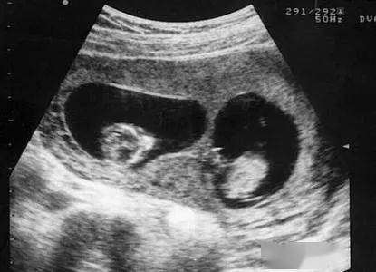 男子瞒着妻女在外找代孕生了两儿子，还付了1100万抚养费，不料……