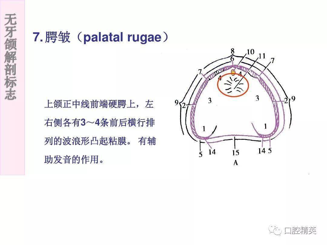 无牙颌解剖标志