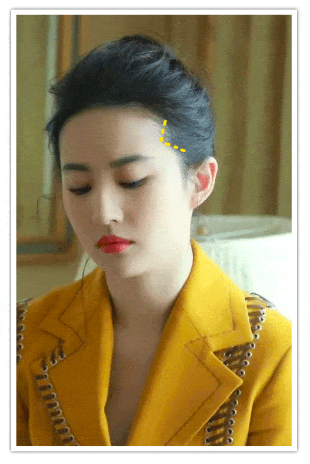 移植|国庆回去，我打算植发了！