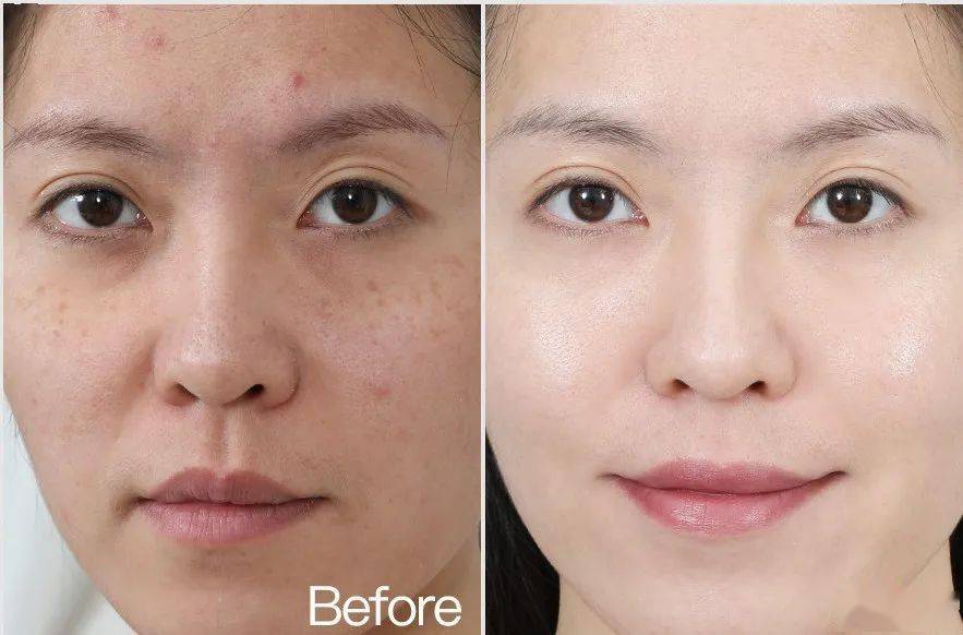 鼻血|“越南杨幂”因太性感被封杀！15秒片段疯传，吸500万人围观：鼻血止不住……