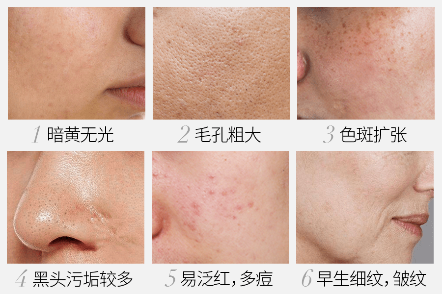 鼻血|“越南杨幂”因太性感被封杀！15秒片段疯传，吸500万人围观：鼻血止不住……