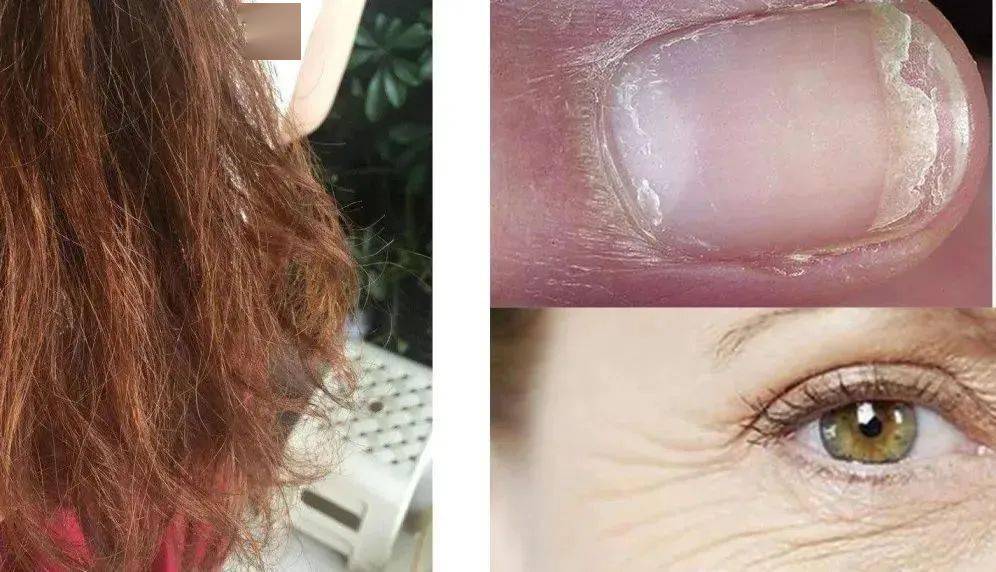 少女|春风吹人老，闲来嚼嚼它，补充胶原蛋白，50岁也能嫩回少女脸~