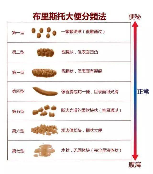 绿便,奶瓣,泡沫,水便分离,警惕便便中暗藏的疾病信号!
