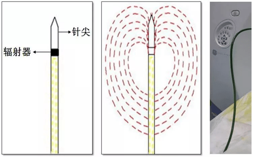 科普肿瘤微创治疗之五虎上将微波消融