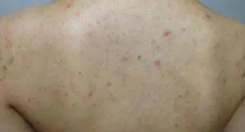 夏天怎样保护皮肤晒不黑 f54cd46bf8e7499791d9e060a3c1dcf5.jpeg