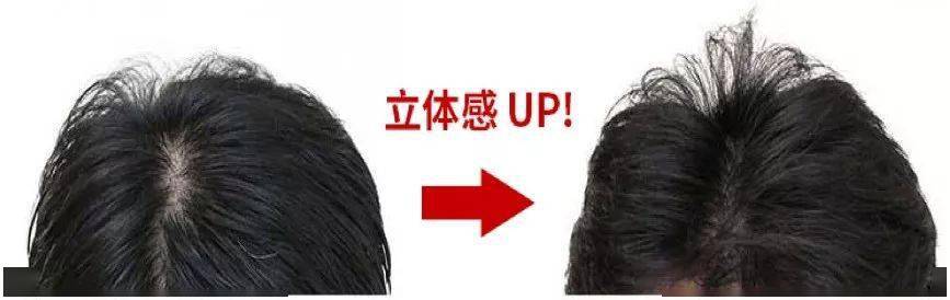 品牌|热销260万个的菊星洗发皂，日本天皇御用品牌，轻松搞定油腻脱发！