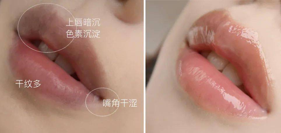 嘴唇|那些懂得珍爱自己的女孩儿，过得比较开心