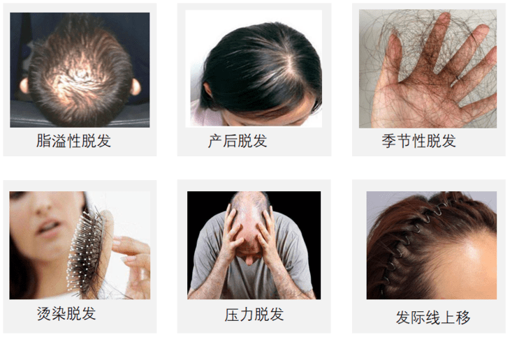 国货|还是老国货好使，头发长出来了，看着真年轻