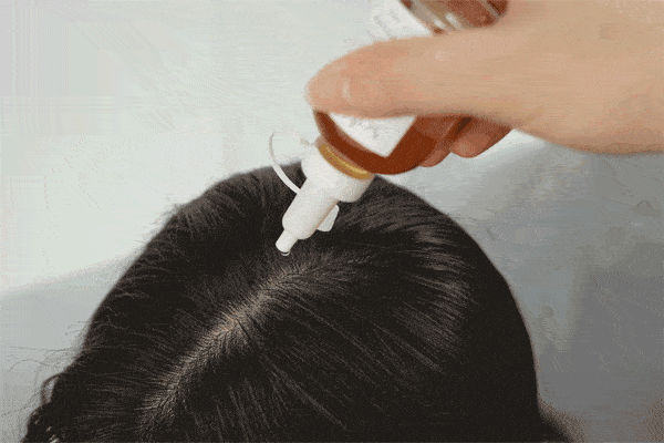 国货|还是老国货好使，头发长出来了，看着真年轻