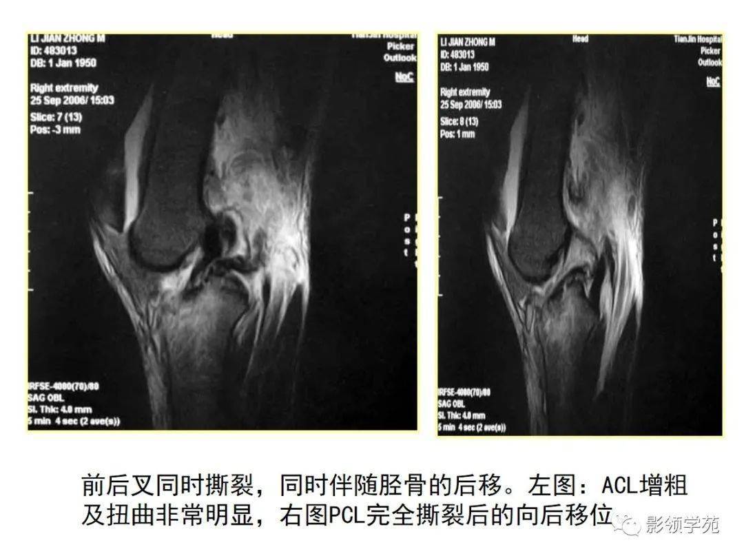 膝窝的准确位置图片,肘窝图片,膝关的准确位置图图(第17页)_大山谷图库