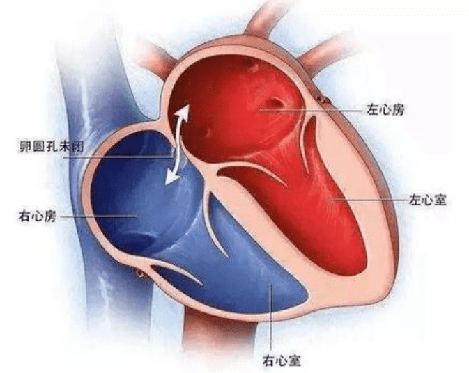 多长|反复头疼、头晕，竟因多长了个“心眼儿”