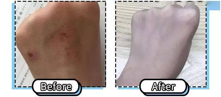 女人|懂得往脸上抹油的女人，还打个P玻尿酸！