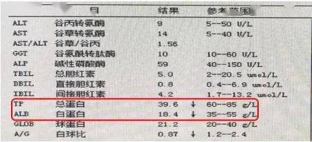患者|寻找 | “追踪”消失的蛋白