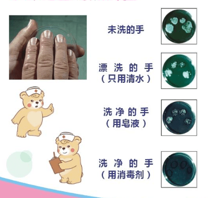 不同的洗手方式 手上细菌差别会有多大呢?