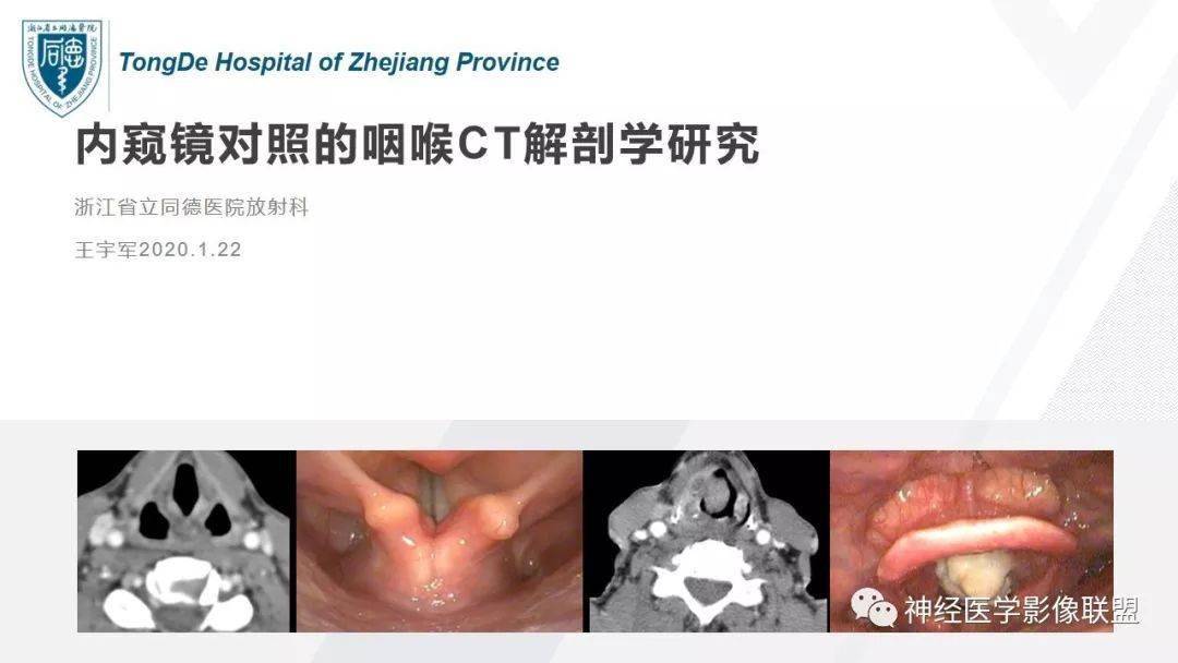 精彩推荐丨内窥镜对照的咽喉部ct解剖