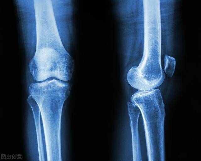 膝盖骨质增生疼吗?